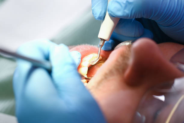 Best Emergency Denture Repair in Oak Point, TX