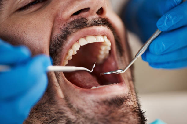 Best Emergency Care for Gum Disease in Oak Point, TX